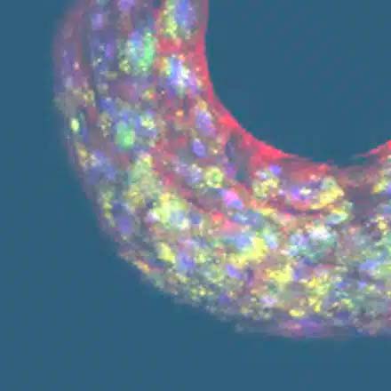 app bio | Gut/Liver on a chip