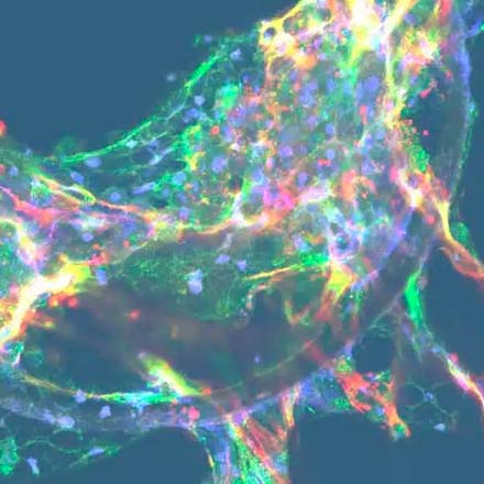 app dm | Gut/Liver on a chip