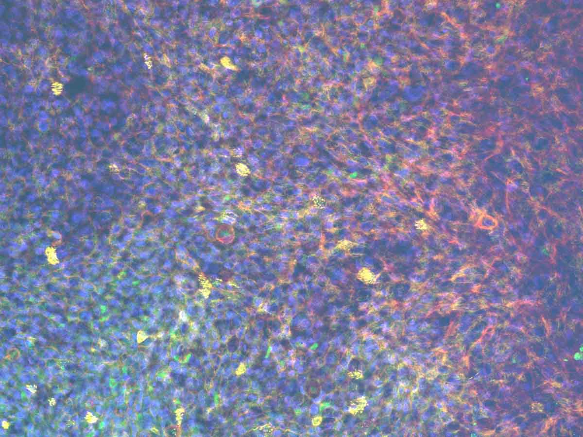 Lung-on-a-chip Drug absorption cells