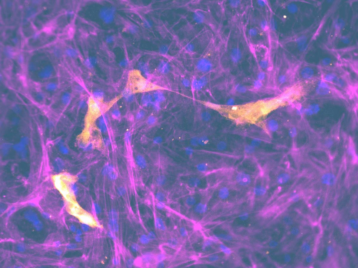 lung-on-a-chip Pulmonary Infeection Cells