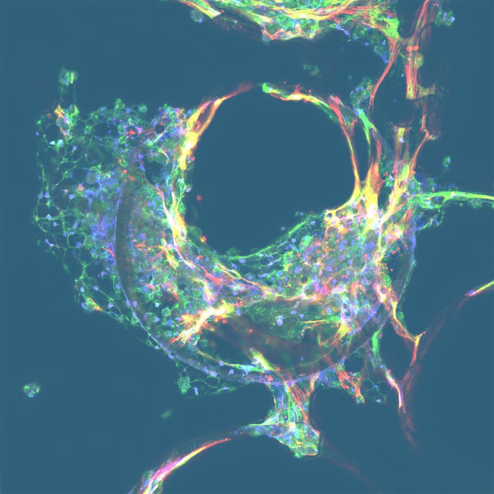 cells 10 | Global fatty liver day
