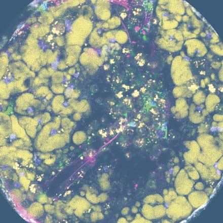 Disease modeling cell image