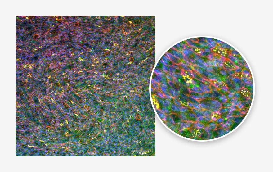 cells | in vitro lung model