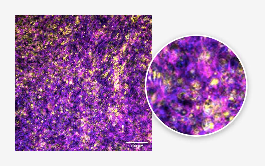 cells2 | in vitro lung model