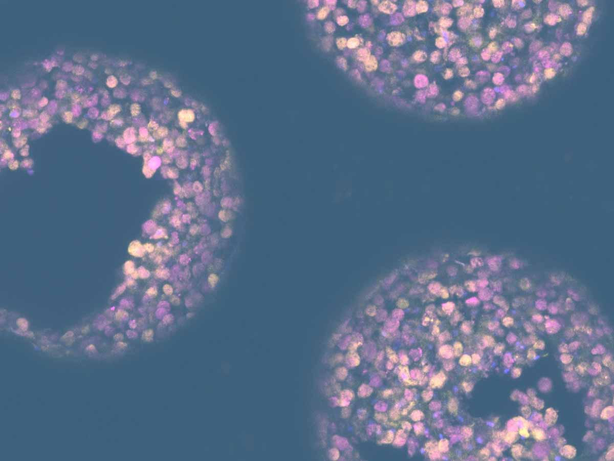 cnb1350 hero bg v1 | oligonucleotide delivery