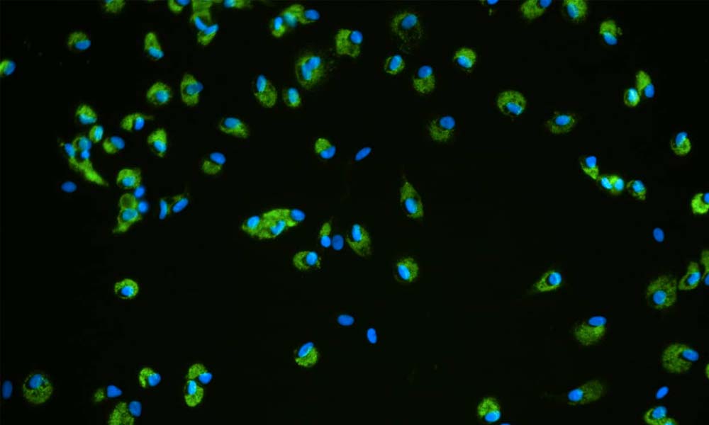 cnb789 dili blog cell tissue | immune-mediated dili