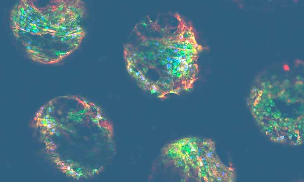 cnb789 dili blog cells | immune-mediated dili