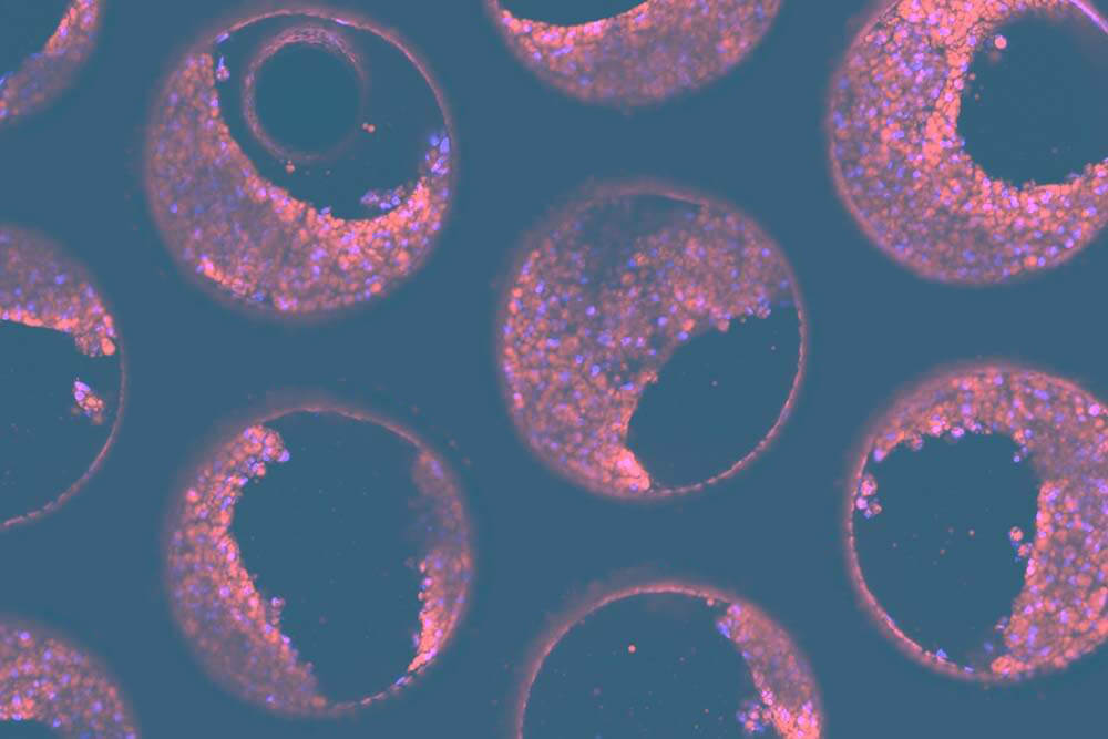 cnb911 nash triple culture v2 | primary cells