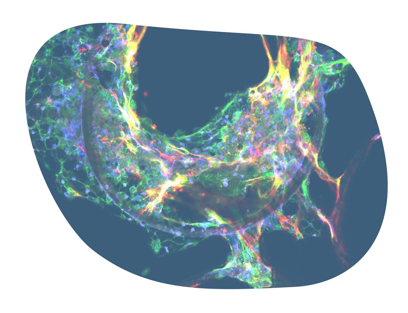  Metabolic Dysfunction-Associated Steatohepatitis Fibrosis Assay