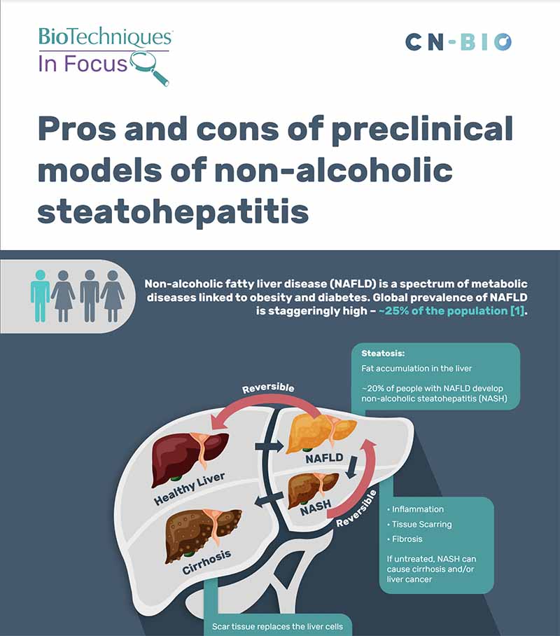 nash info graphic | Metabolic dysfunction-associated steatohepatitis