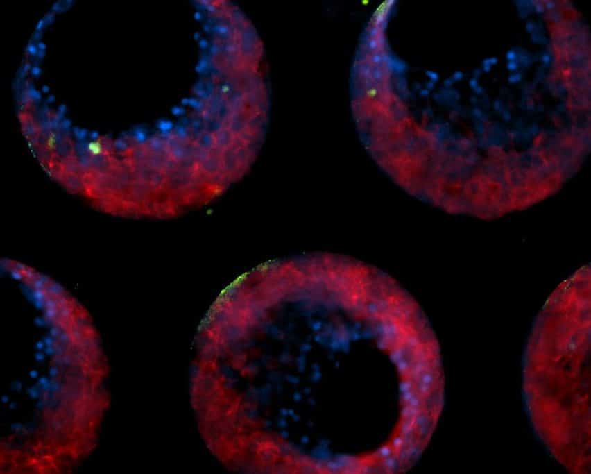 Hepatitis B cells