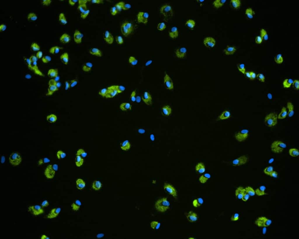 Immune-mediated toxicity cells