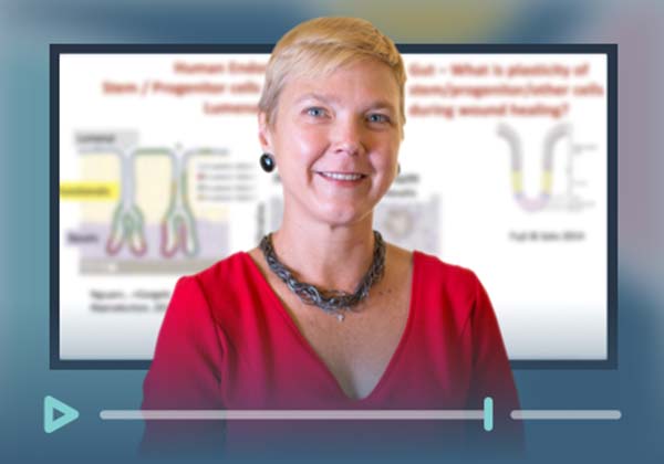 web s2e4 | drug absorption in vitro